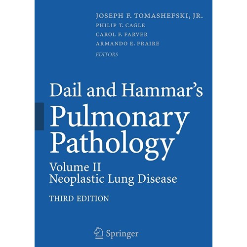 Dail & Hammar'S Pulmonary Pathology 3Ed Vol.2...