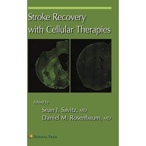 Stroke Recovery With Cellular Therapies (Hb 2...