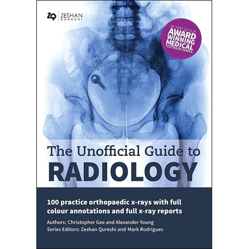 The Unofficial Guide To Radiology 100 Practic...