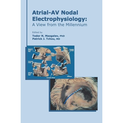 Atrial-Av Nodal Electrophysiology - A View Fr...