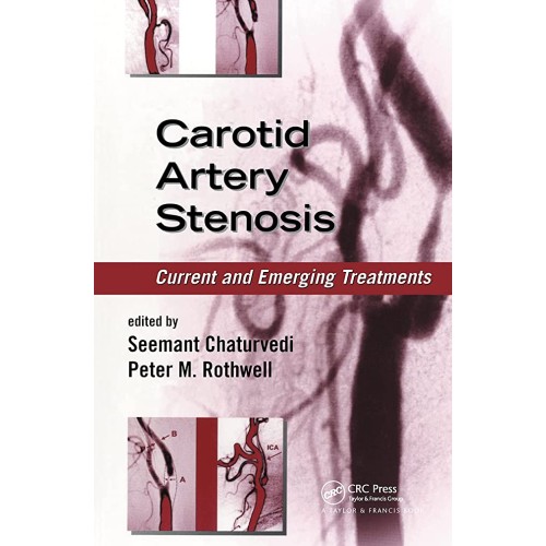 Carotid Artery Stenosis Current And Emerging ...