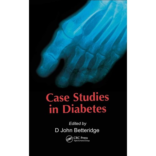 Fifty Cases In Diabetes 