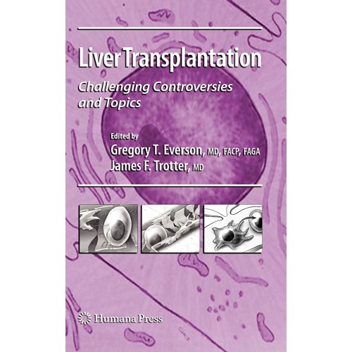 Liver Transplantation (Pb 2008)