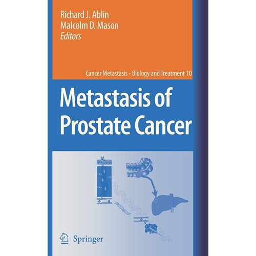 Metastasis Of Prostate Cancer (Hb) 