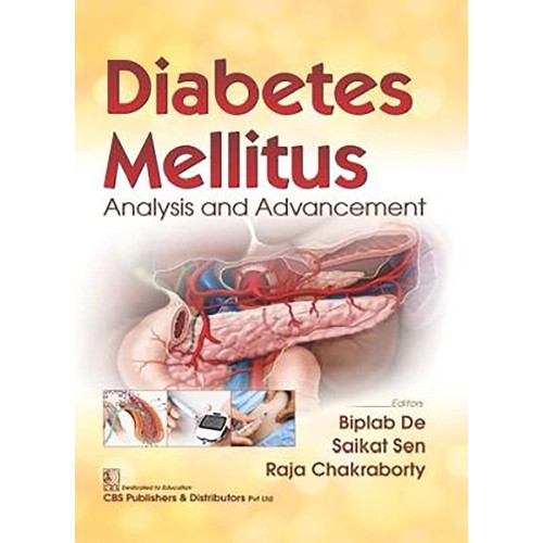 Diabetes Mellitus Analysis And Advancement (P...