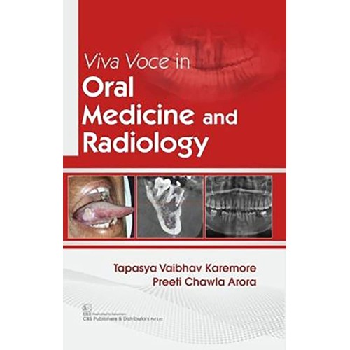 Viva Voce In Oral Medicine And Radiology (Pb ...