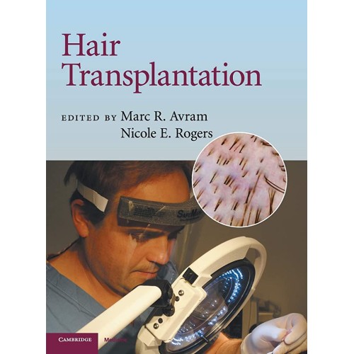 Hair Transplantation (Hb 2010) 