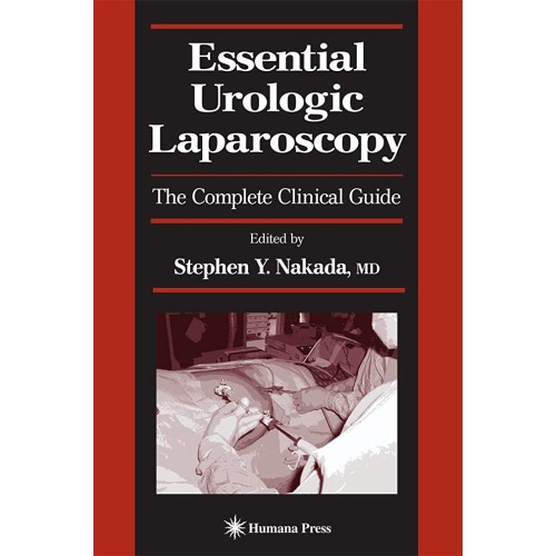 Essential Urologic Laparoscopy: The Complete ...