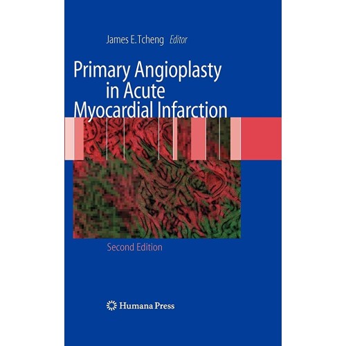 Primary Angioplasty In Acute Myocardial Infar...