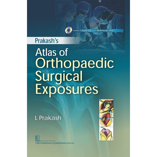 Prakash Atlas Of Orthopaedic Surgical Exposur...