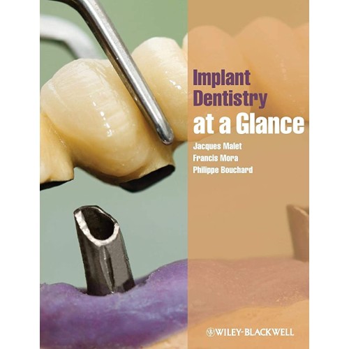 Implant Dentistry At A Glance (Pb) 