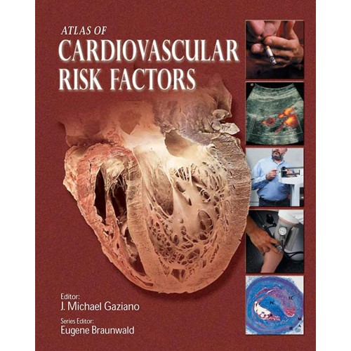 Atlas Of Cardiovascular Risk Factors 