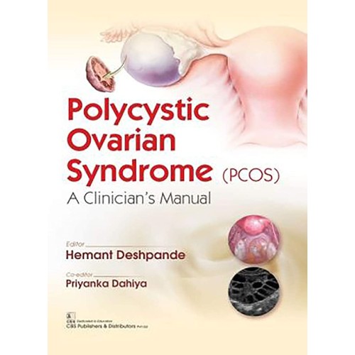 Polycystic Ovarian Syndrome (Pcos) A Clinicia...