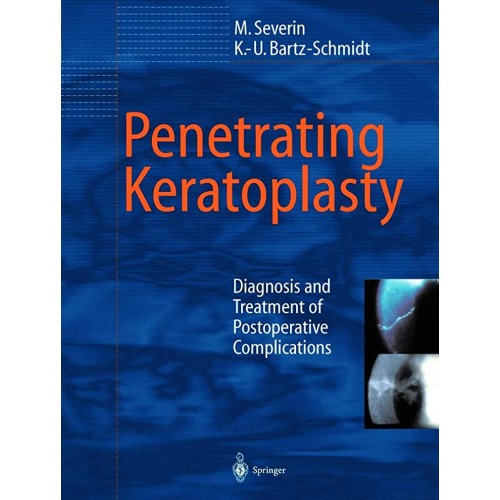 Penetrating Keratoplasty 