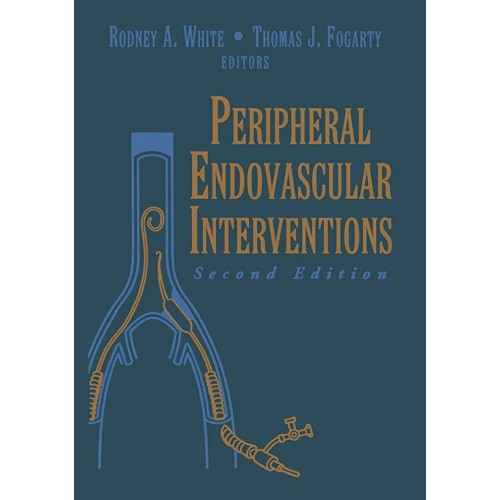 Peripheral Endovascular Interventions ;2/E 