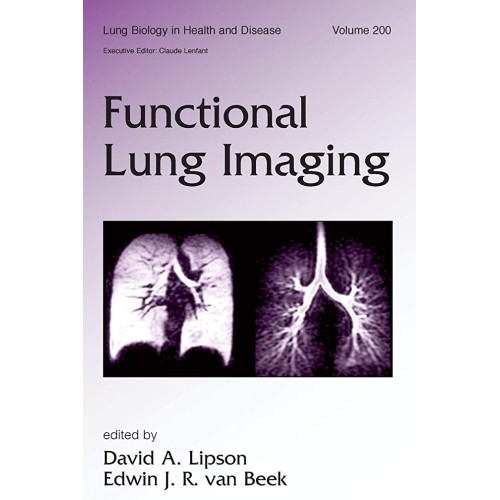 Functional Lung Imaging, Vol-200 (Lung Biolog...