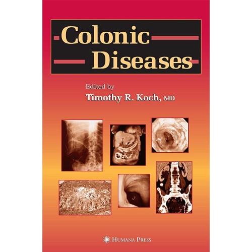 Colonic Diseases 