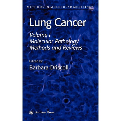 Lung Cancer: Molecular Pathology Methods And ...