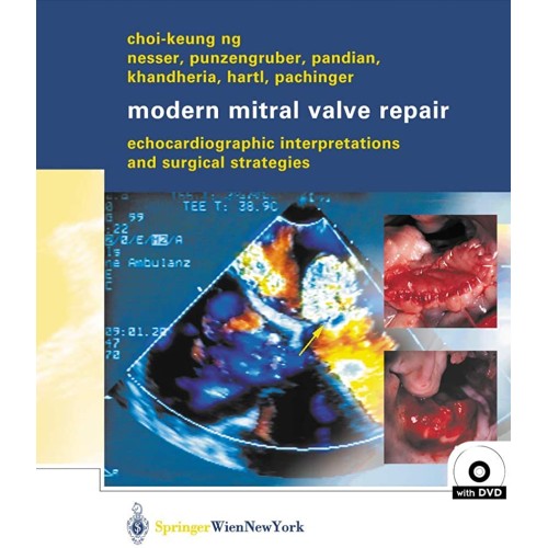 Modern Mitral Valve Repair (Hb) 