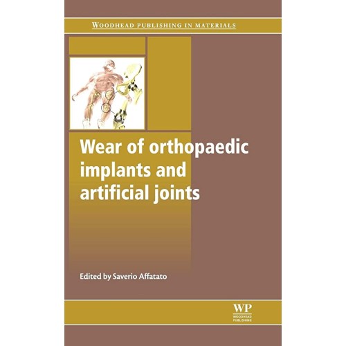 Wear Of Orthopaedic Implants And Artificial J...