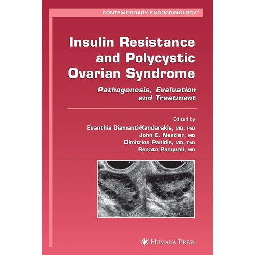 Insulin Resistance And Polycystic Ovarian Syn...