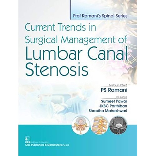 Current Trends In Surgical Management Of Lumb...