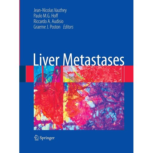 Liver Metastases (Hb 2009)