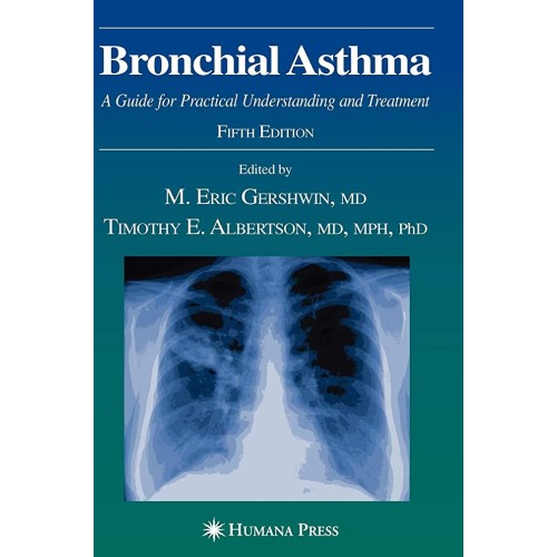 Bronchial Asthma: A Guide For Practical Under...