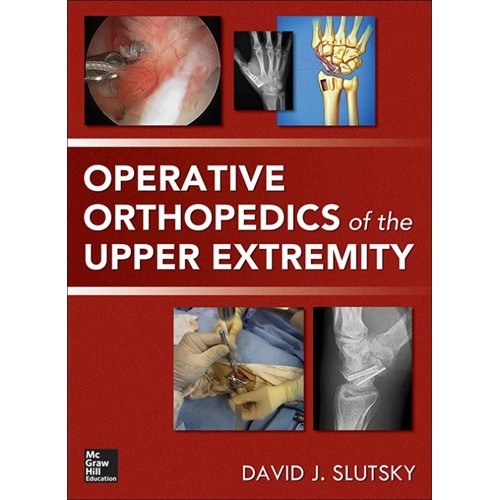 Operative Orthopedics Of The Upper Extremity ...