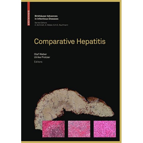 Comparative Hepatitis (Hb) 