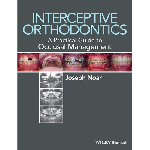 Interceptive Orthodontics  A Practical Guide ...