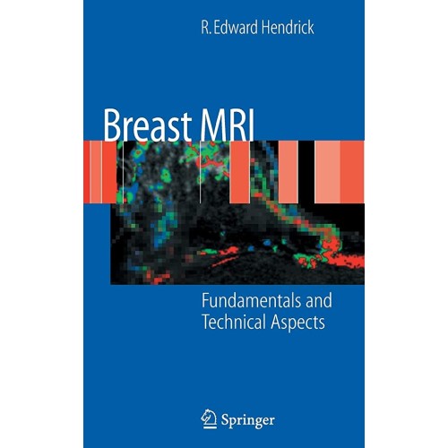 Breast Mri: Fundamentals And Technical Aspect...