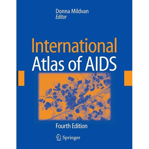 International Atlas Of Aids, 4/E 