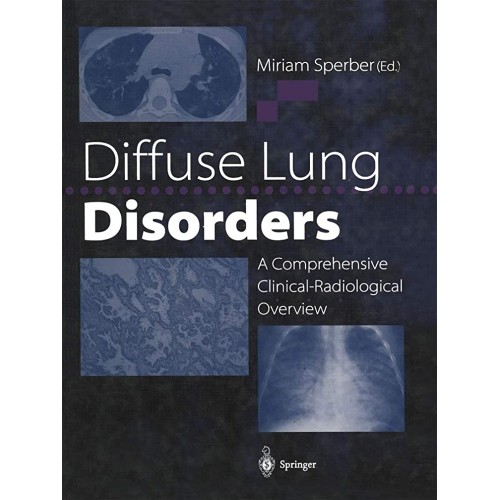 Diffuse Lung Disorders 