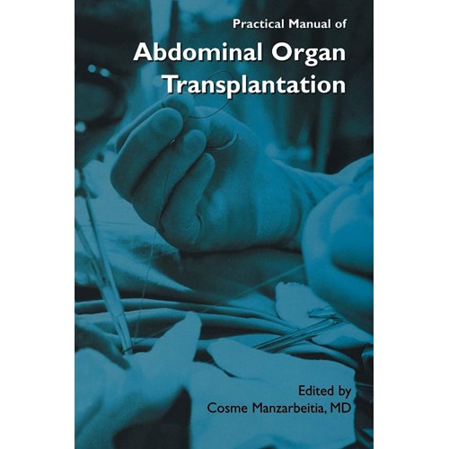 Practical Manual Of Abdominal Organ Transplan...