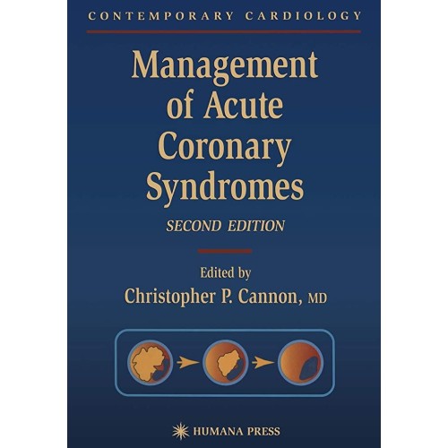 Management Of Acute Coronary Syndromes, 2 Ed 