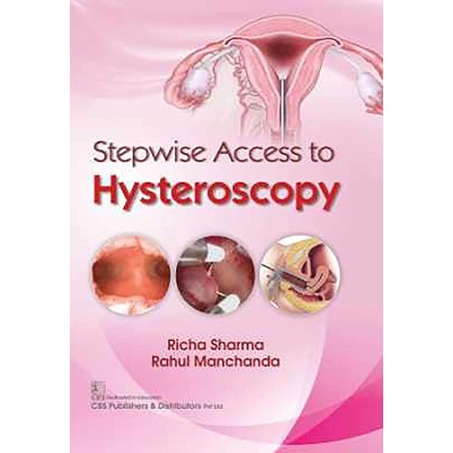 Stepwise Access To Hysteroscopy (Hb 2020) 