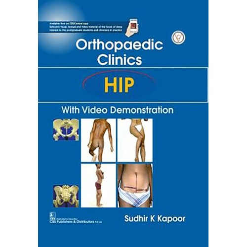 Orthopaedic Clinics Hip With Video Demonstrat...