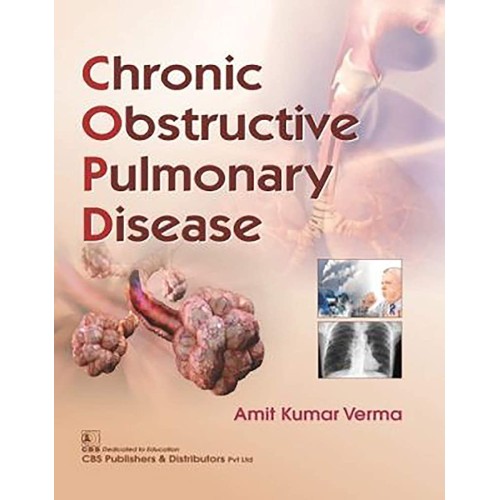 Chronic Obstructive Pulmonary Disease (Pb 201...