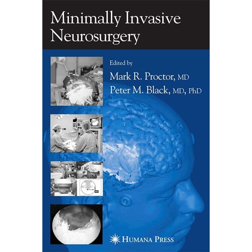 Minimally Invasive Neurosurgery (Hb) 