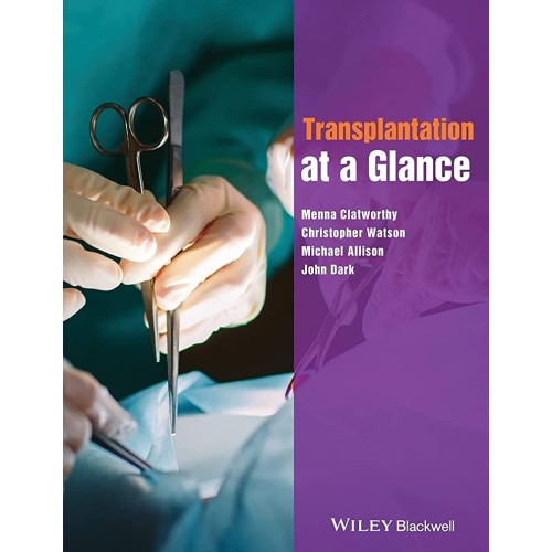 Transplantation At A Glance (Pb 2012) 