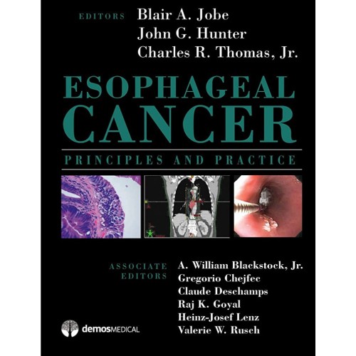 Esophageal Cancer Principles And Practice (Hb...