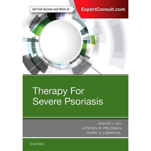 Therapy For Severe Psoriasis (Hb 2017) 