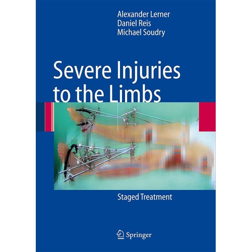 Severe Injuries To The Limbs: Staged Treatmen...