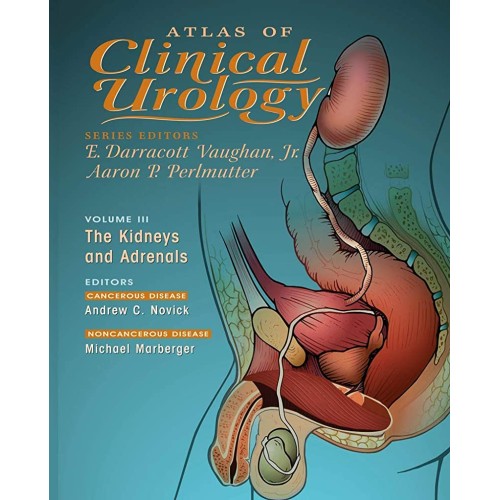 Atlas Of Clinical Urology: The Kidneys And Ad...