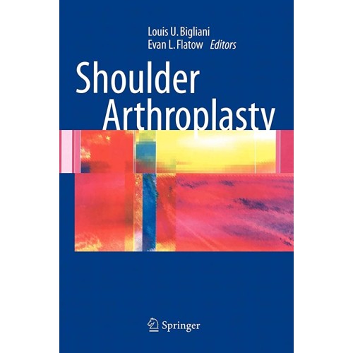 Shoulder Arthroplasty (Hb) 