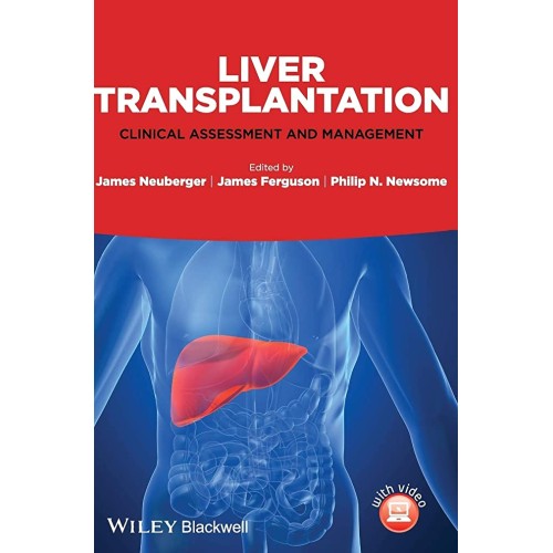 Liver Transplantation Clinical Assessment And...