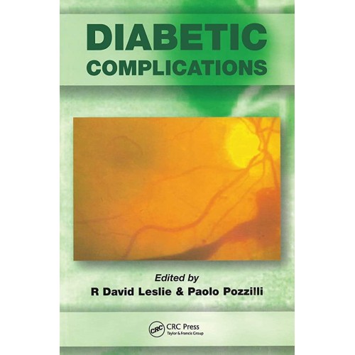 Diabetic Complications: New Diagnostic Tools ...