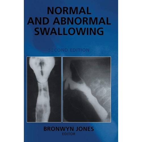 Normal And Abnormal Swallowing: Imaging In Di...