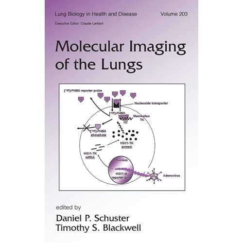 Molecular Imaging Of The Lungs 